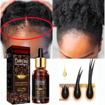 Alopecie Vlasy Ošetření pro Ženy, vypadávání vlasů Oleje na Vlasy Růst Nástroj Sprej Kofein pro Ošetření Suché, Krepaté Poškozené Tenké Péči o Vlasy